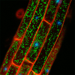 A galactosyltransferase critical for AGP biosynthesis